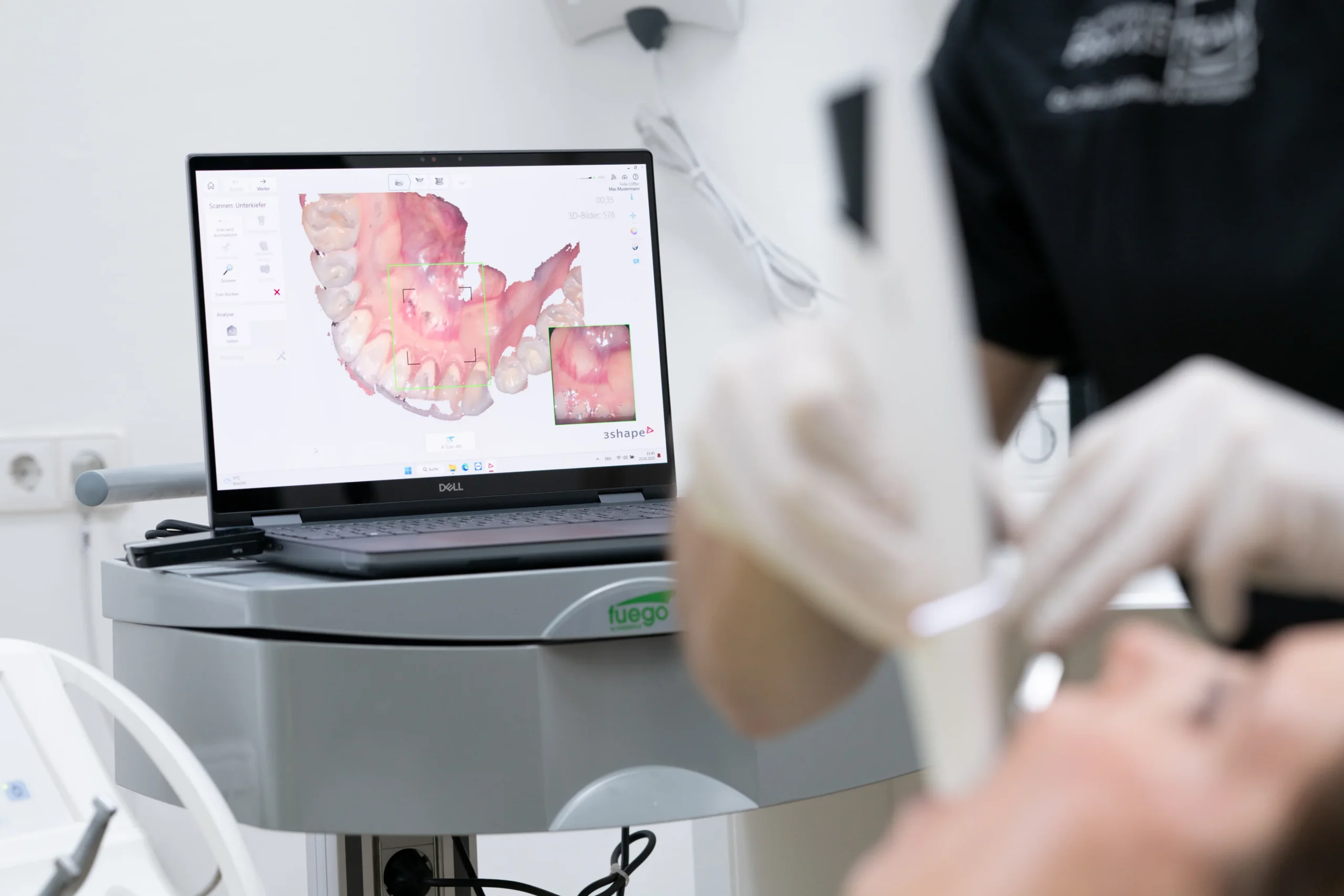 Digitales 3D-Zahnmodell zur Planung einer modernen Wurzelkanalbehandlung.